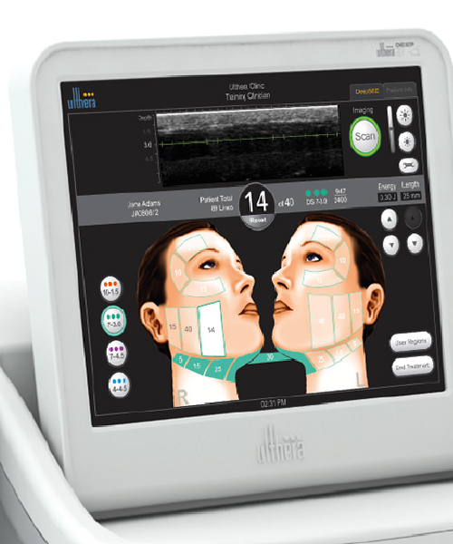 Médecine esthétique - Ulthéra® : lifting du visage & décolleté par ultrasons Paris - Phoenix Esthetic