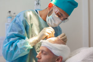 Greffe de Cheveux FUE à Paris | Sans Cicatrices | Phoenix Esthétic