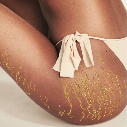 Eliminer la cellulite - Phoenix Esthetic