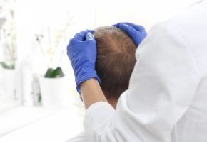 Quand faire la greffe de cheveux ? Médecine Capillaire - Greffe de Cheveux FUE PARIS