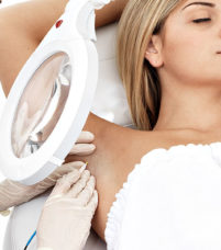 Épilation définitive - Epilation électrique à haute fréquence- Apilus Paris - Phoenix Esthetic