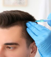 Quel âge faut-il avoir pour faire une greffe de cheveux ? - Quel âge faut-il avoir pour faire une greffe de cheveux ? - Phoenix Esthetic