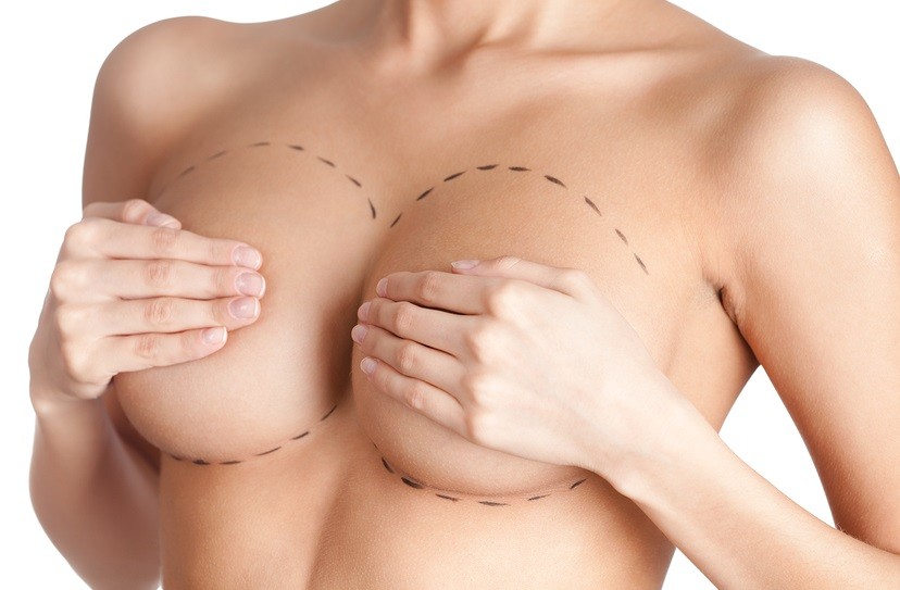 Chirurgie esthétique - Le lipofilling mammaire Paris - Phoenix Esthetic