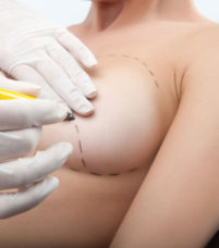 Chirurgie esthétique - Augmentation mammaire Paris - Phoenix Esthetic