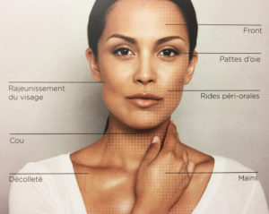 Skinboosters - Traitement Acide Hyaluronique - Médecine Esthétique Paris - Phoenix Esthetic