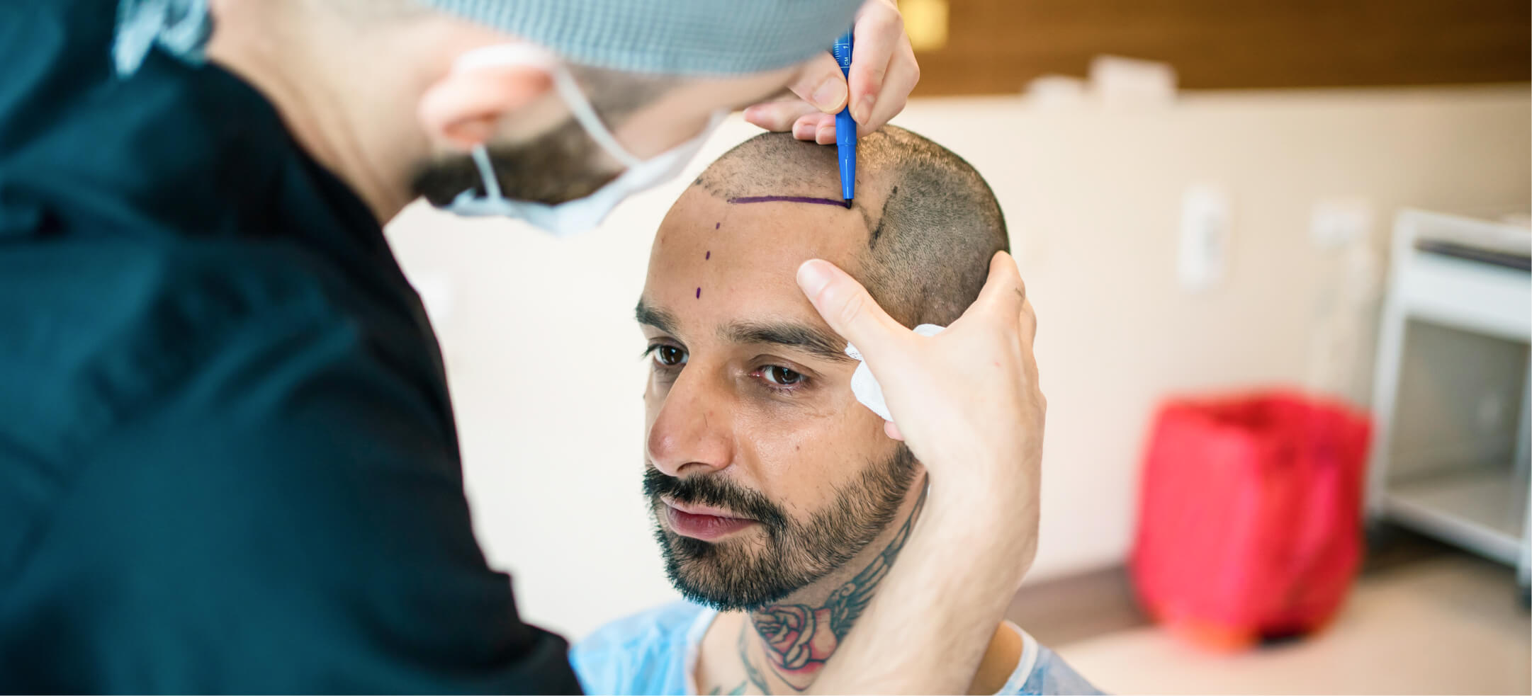 Greffe cheveux FUE Paris - Greffe Capillaire - Phoenix Esthetic