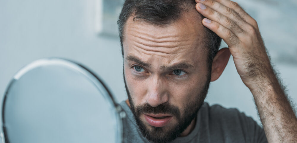 Comment stopper la chute de cheveux chez les hommes ? - Comment stopper la chute de cheveux chez les hommes ? - Phoenix Esthetic