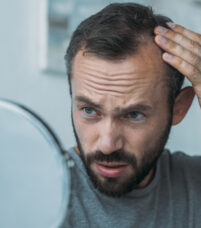 Comment stopper la chute de cheveux chez les hommes ? - Comment stopper la chute de cheveux chez les hommes ? - Phoenix Esthetic