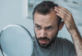 Comment stopper la chute de cheveux chez les hommes ? - Comment stopper la chute de cheveux chez les hommes ? - Phoenix Esthetic